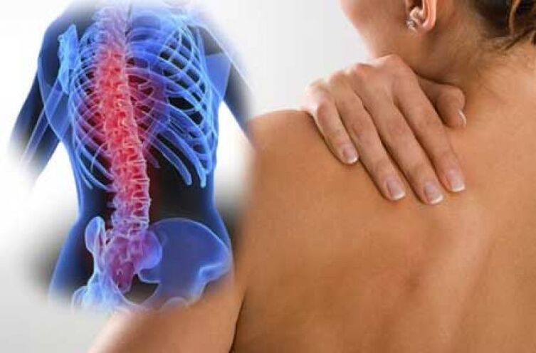 مع تفاقم تنخر العظم في العمود الفقري الصدري ، يحدث ألم الظهر