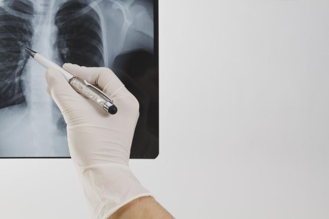الأشعة السينية لتشخيص الداء العظمي الغضروفي